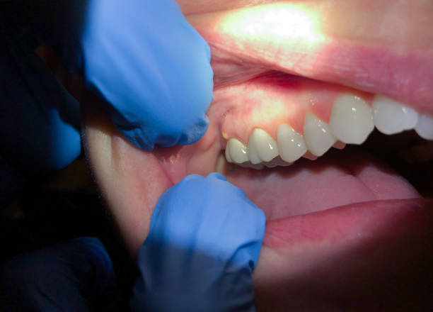 Best Weekend Emergency Dentist in Oakwood Hls, IL