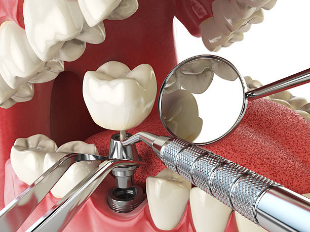 Best Emergency Dentist for Knocked-Out Tooth in Oakwood Hls, IL